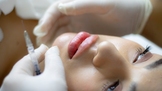 Benefits and Harms of Having a Jawline Filler